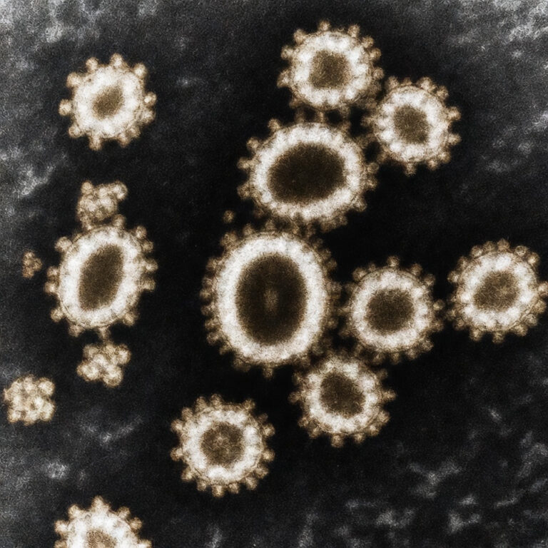 Nipah Virus in West Bengal